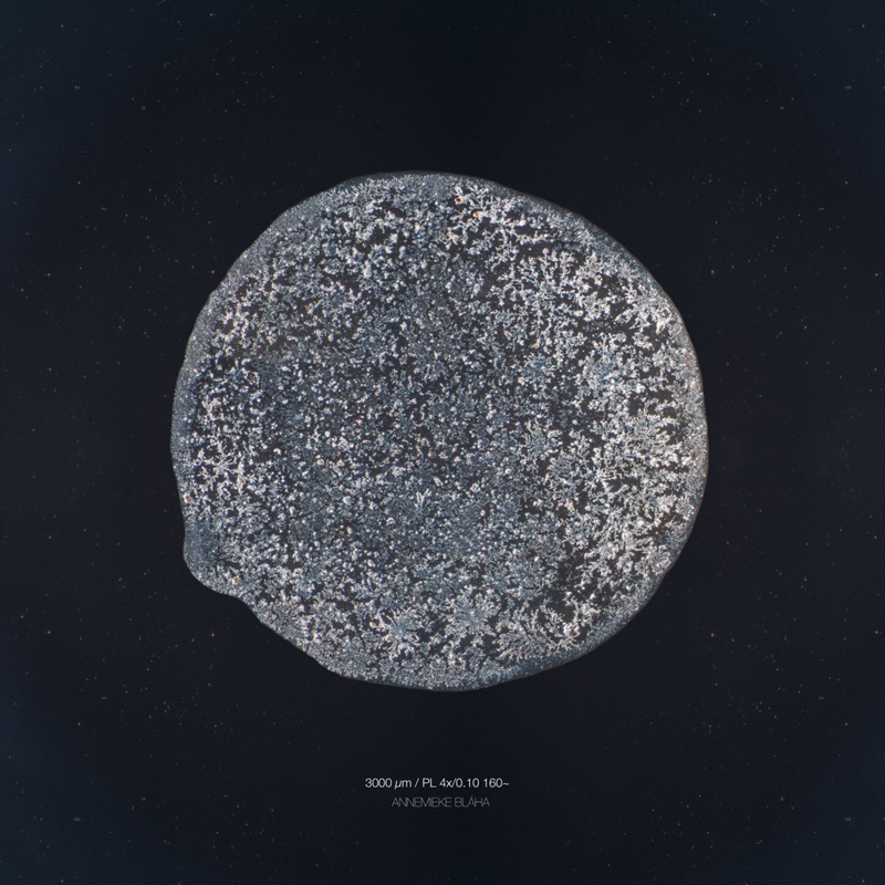 Illustration for article titled The Beautiful Secrets of Tears, Revealed By a Microscope